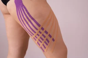 Lee más sobre el artículo Kinesiotape estético ¿Quita las arrugas o solo las empeora?